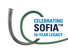 MicroVention庆祝SOFIA抽吸导管问世10周年和持久传承以及在全球170个国家/地区完成50多万例手术